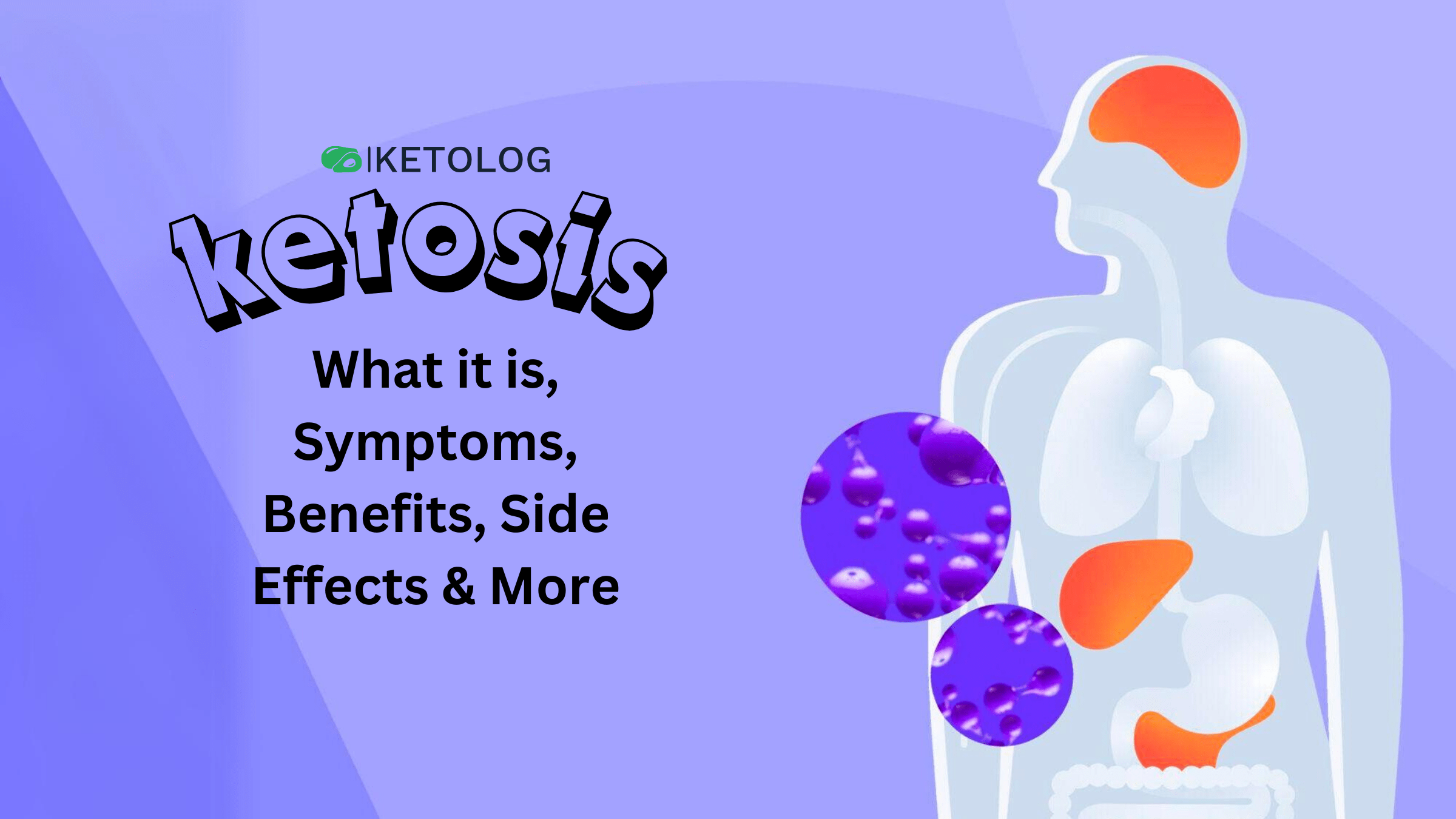 what is ketosis